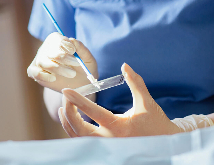 Sadece 5 Dakika, Bir Ömür Sağlık: Smear Testinin Hayati Önemi